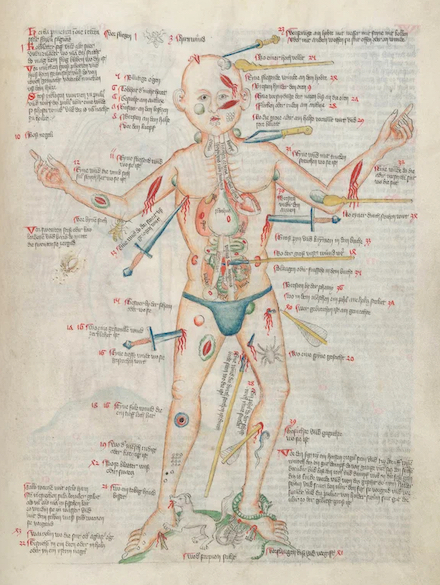 Wound Man: surgical diagram circa 1420 CE